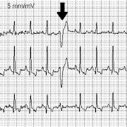 ECG of a dog