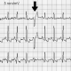 ECG of a dog
