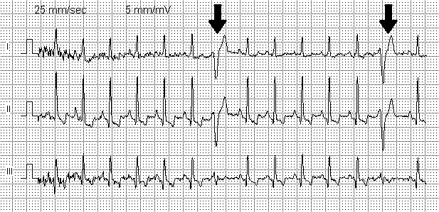 ECG of a dog ECG of a dog