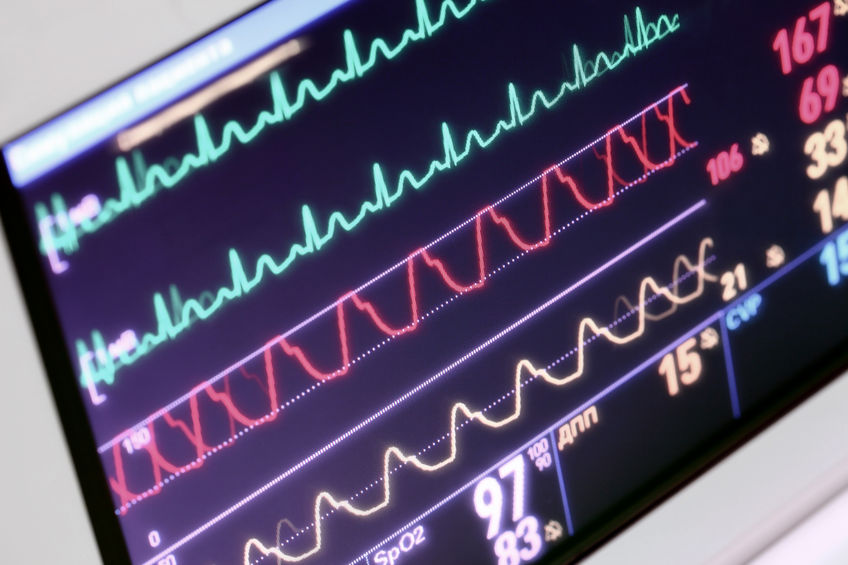 Monitoring of the patient in the ICU